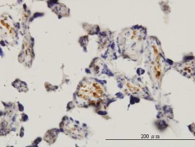 Immunohistochemistry-Paraffin: MNK1 Antibody (2H8) [H00008569-M08]