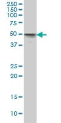 Western Blot: MNK1 Antibody (2H8) [H00008569-M08]