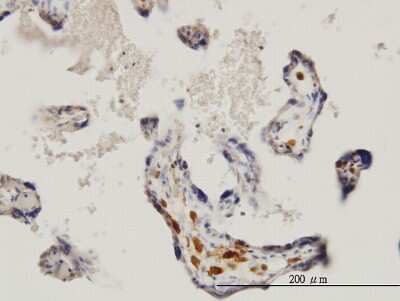 Immunohistochemistry-Paraffin: MNK1 Antibody (3E1) [H00008569-M06]