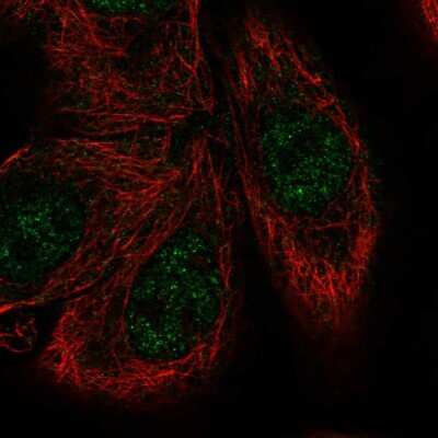 Immunocytochemistry/ Immunofluorescence: MNK1 Antibody [NBP2-56054]