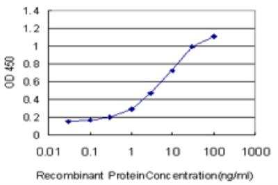 ELISA: MNK2 Antibody (2A10) [H00002872-M07]