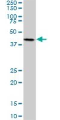 Western Blot: MNK2 Antibody (2A10) [H00002872-M07]