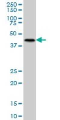 Western Blot: MNK2 Antibody (2A10) [H00002872-M07]