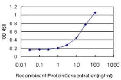 ELISA: MNK2 Antibody (4F11) [H00002872-M04]