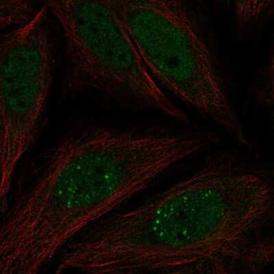 Immunocytochemistry/ Immunofluorescence: MNK2 Antibody [NBP2-68901]