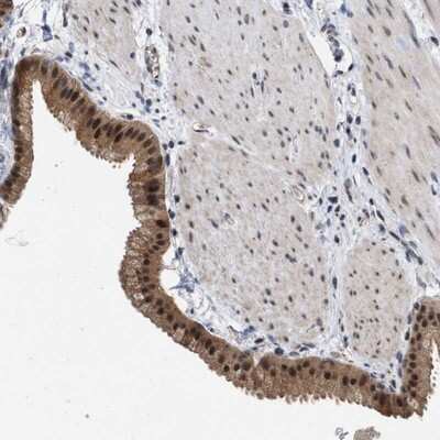 Immunohistochemistry-Paraffin: MNK2 Antibody [NBP1-92129]