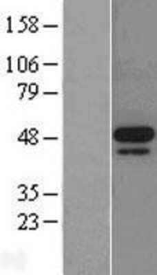 Western Blot: MNK2 Overexpression Lysate [NBL1-13125]