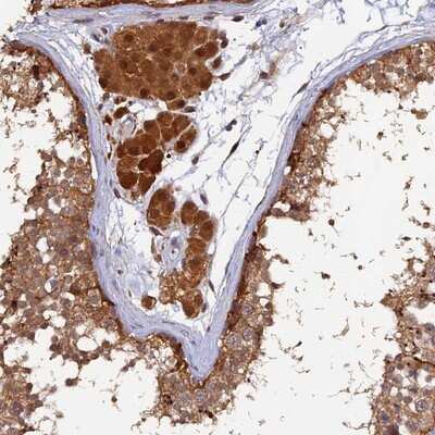 Immunohistochemistry-Paraffin: MNS1 Antibody [NBP1-83763]
