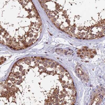 Immunohistochemistry-Paraffin: MNS1 Antibody [NBP1-83764]