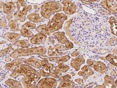 Immunohistochemistry-Paraffin: MNS1 Antibody [NBP2-98191]