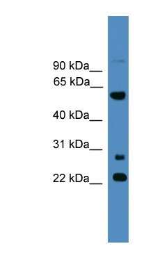 Western Blot: MNS1 Antibody [NBP1-69201]