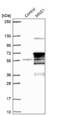 Western Blot: MNS1 Antibody [NBP1-83764]