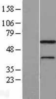 Western Blot: MNS1 Overexpression Lysate [NBL1-13166]