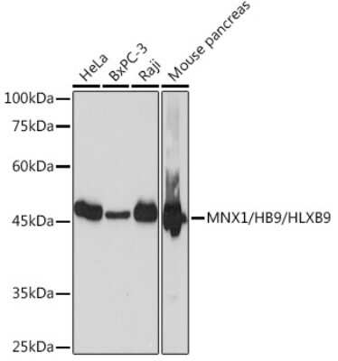 Western Blot: MNX1/HLXB9 Antibody (9P1B7) [NBP3-15861]