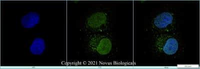 Immunocytochemistry/ Immunofluorescence: MNX1/HLXB9 Antibody [NBP2-24691]