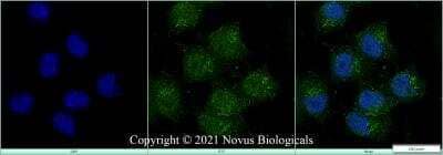 Immunocytochemistry/ Immunofluorescence: MNX1/HLXB9 Antibody [NBP2-24691]