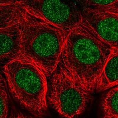 Immunocytochemistry/ Immunofluorescence: MNX1/HLXB9 Antibody [NBP2-57703]