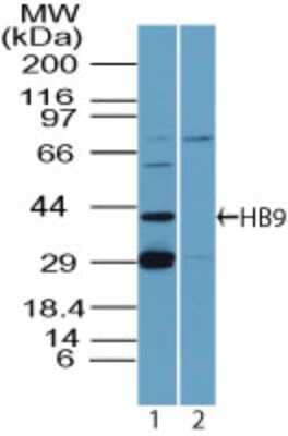 Western Blot: MNX1/HLXB9 Antibody [NBP2-24691]