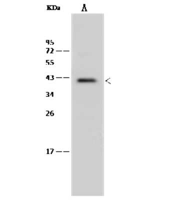 Western Blot: MNX1/HLXB9 Antibody [NBP2-99434]