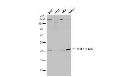 Western Blot: MNX1/HLXB9 Antibody [NBP3-13412]