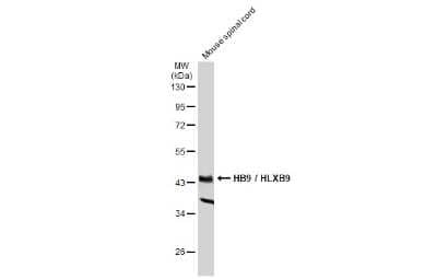 Western Blot: MNX1/HLXB9 Antibody [NBP3-13412]