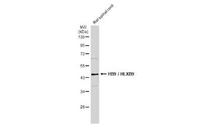Western Blot: MNX1/HLXB9 Antibody [NBP3-13412]