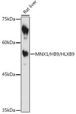 Western Blot: MNX1/HLXB9 AntibodyAzide and BSA Free [NBP3-16042]