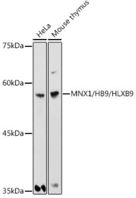 Western Blot: MNX1/HLXB9 AntibodyAzide and BSA Free [NBP3-16042]