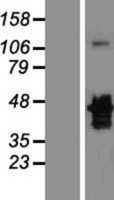 Western Blot: MNX1/HLXB9 Overexpression Lysate [NBL1-13167]