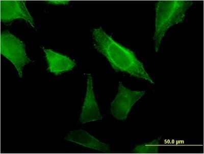 Immunocytochemistry/ Immunofluorescence: MOB4A Antibody (2F8) [H00092597-M07]