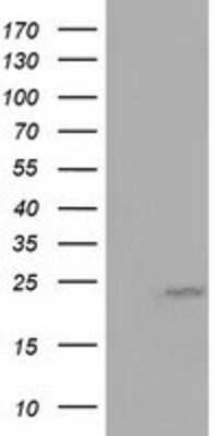 Western Blot: MOB4A Antibody (OTI3G9) [NBP2-02715]