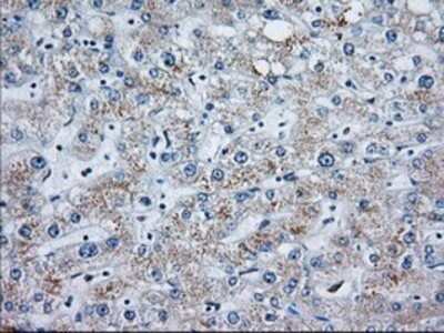 Immunohistochemistry: MOB4A Antibody (OTI3G9) - Azide and BSA Free [NBP2-72744]