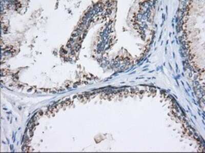 Immunohistochemistry: MOB4A Antibody (OTI3G9) - Azide and BSA Free [NBP2-72744]