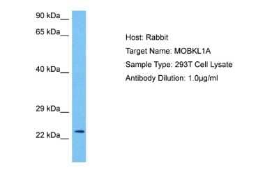 Western Blot: MOB4A Antibody [NBP2-86710]