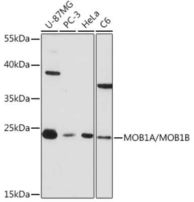 Western Blot: MOB4A/MOBKL1B AntibodyAzide and BSA Free [NBP2-95097]