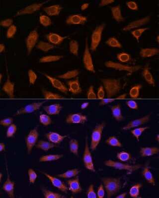 Immunocytochemistry/ Immunofluorescence: MOB4A/MOBKL1B Antibody - Azide and BSA Free [NBP2-95097]