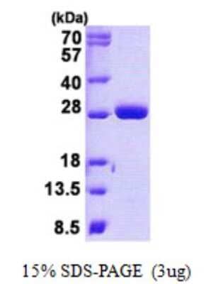 SDS-PAGE: Recombinant Human MOB4A His Protein [NBP2-23248]