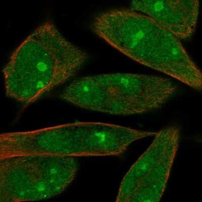 Immunocytochemistry/ Immunofluorescence: MOBKL1B Antibody [NBP2-57643]