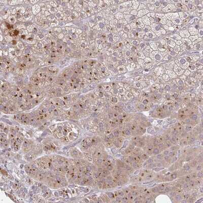 Immunohistochemistry: MOBKL1B Antibody [NBP2-32051]