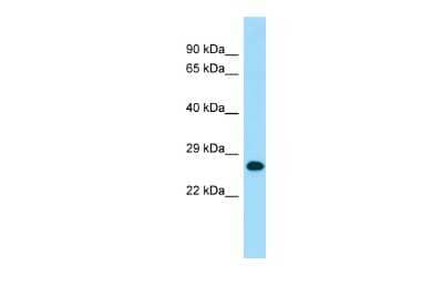 Western Blot: MOBKL1B Antibody [NBP3-09468]