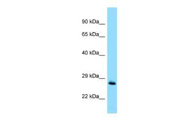 Western Blot: MOBKL1B Antibody [NBP3-09469]