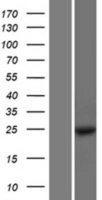 Western Blot: MOBKL1B Overexpression Lysate [NBP2-06844]