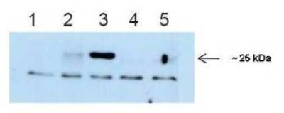 Western Blot: MOBKL2A Antibody [NBP1-68979]