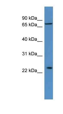 Western Blot: MOBKL2A Antibody [NBP1-68979]