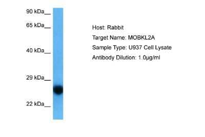 Western Blot: MOBKL2A Antibody [NBP2-84166]