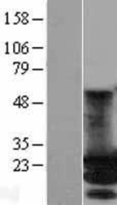 Western Blot: MOBKL2A Overexpression Lysate [NBL1-13171]