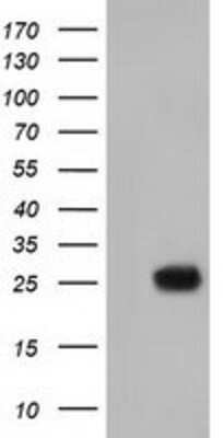 Western Blot: MOBKL2B Antibody (OTI6C6) [NBP2-02843]