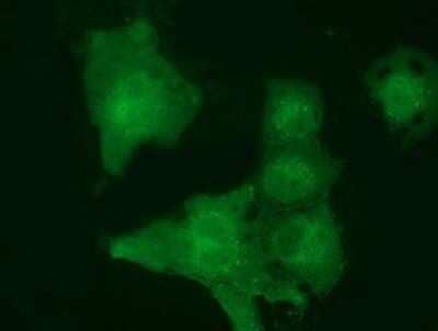 Immunocytochemistry/ Immunofluorescence: MOBKL2B Antibody (OTI6C6) - Azide and BSA Free [NBP2-72748]