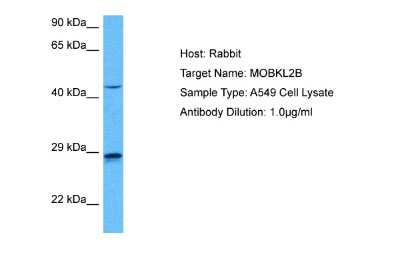 Western Blot: MOBKL2B Antibody [NBP2-84167]