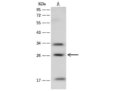 Western Blot: MOBKL2B Antibody [NBP2-99376]